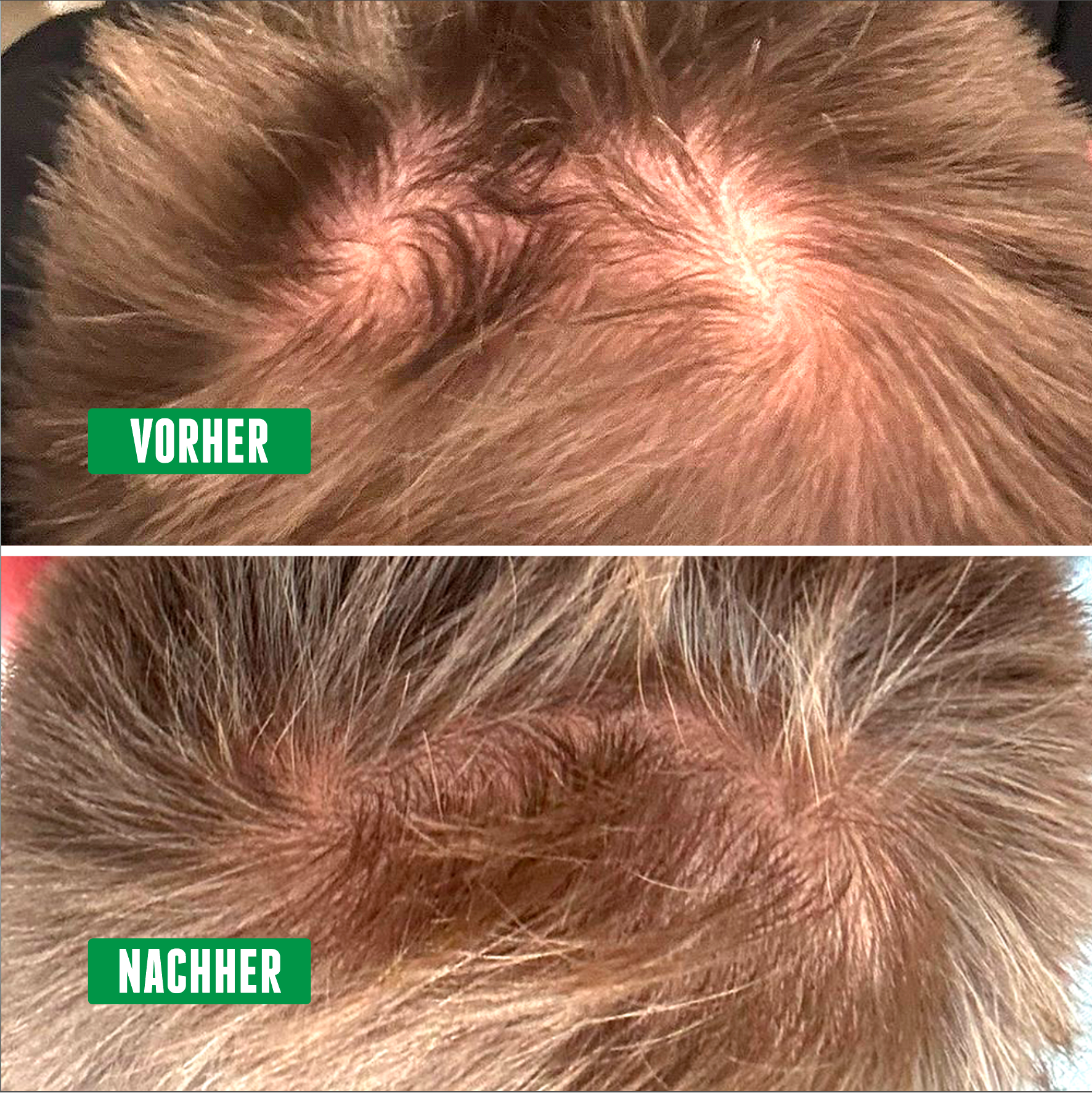 Vergleich von Kopfhaut vor und nach Anwendung – oben licht, unten dichter bewachsen.