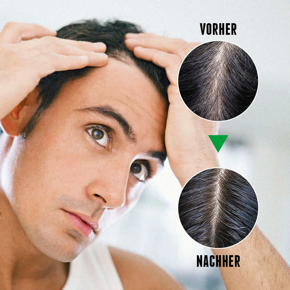 Das Activator Hair Tonic für sichtbare Ergebnisse und mehr Haare im vorher-nachher Vergleich.