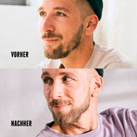 Zweiteiliges Vorher-Nachher-Bild eines Mannes mit Mütze; im unteren Bild wirkt sein Bart voller und dichter.